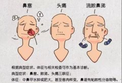 成都鼻甲肥大不治会带来哪些危害