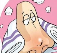 鼻甲肥大患者需要注意什么