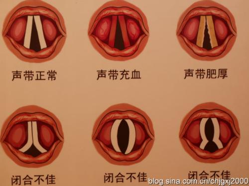 成都治疗声带小结仁品医院电话是多少