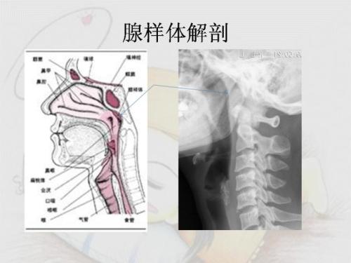 成都仁品腺样体肥大怎样治疗?