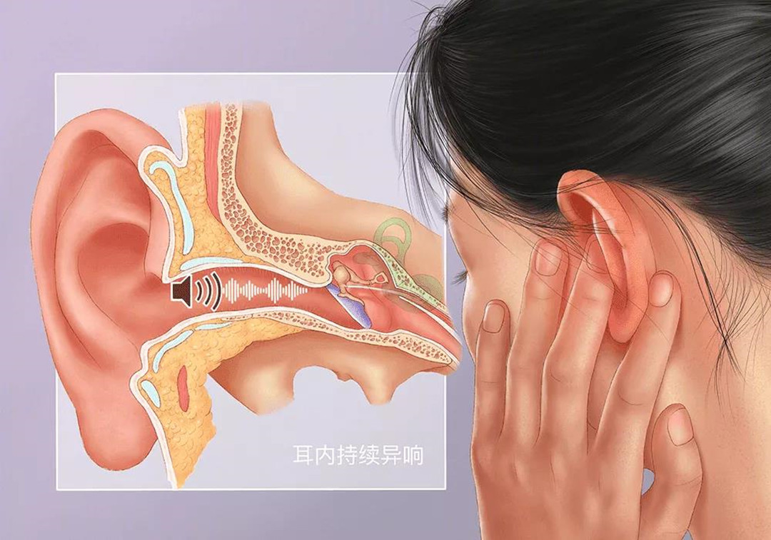 成都耳朵嗡嗡响怎么治才好?